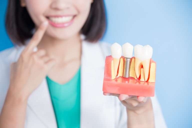 femme dentiste touchant une dent implantée